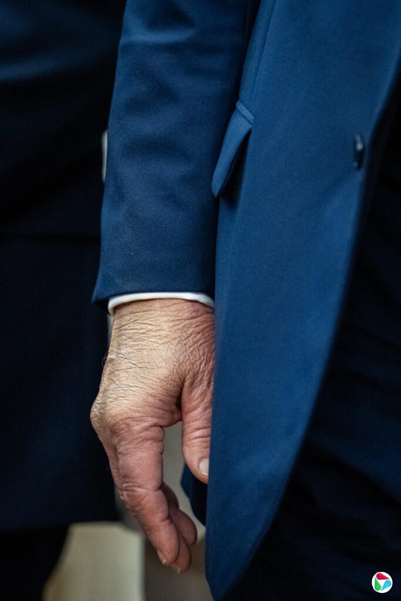 周二,美总统特朗普在椭圆形办公室露面时,可以看到他右手使用了化妆品。