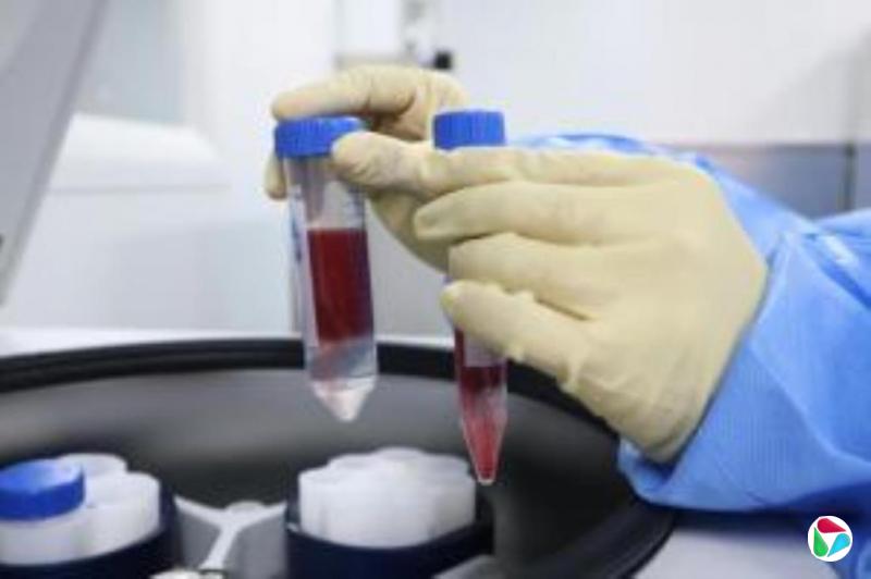 研究:新合成蛋白质可助力清除废弃细胞