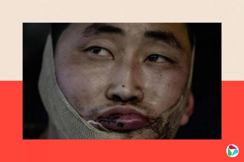 乌克兰总统弗拉基米尔·泽连斯基发布的一张照片,据称显示两名被俘朝鲜士兵中的其中一人。